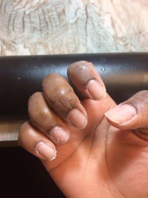 My nails after the 40 minute acetone soak & poor electric filing, and before the "technician" got ready to glue on fake nails