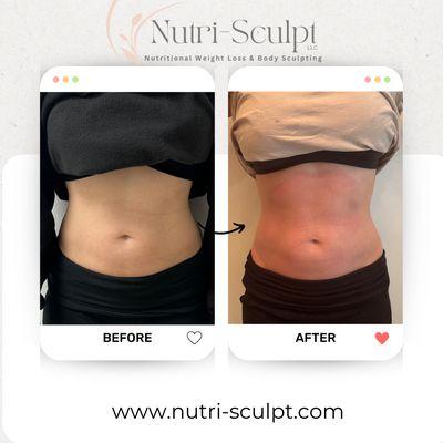 Nutrí-Sculpt