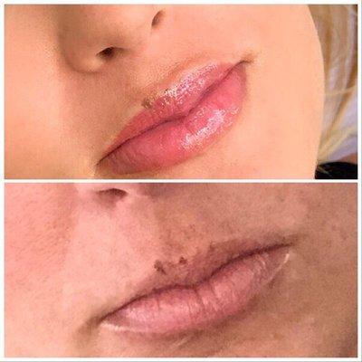 Lips blush color correction