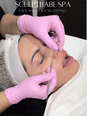 Licensed Esthetician performs extractions during facial a treatment which your clogged or compacted pores are cleared