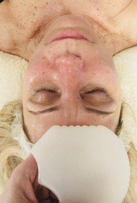 Gua Sha treatment performed on the right side of the face