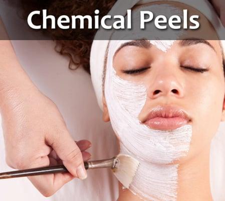 We offer Lactic, Glycolic & Salicylic peels. Also, Renaissance 2 Peel, Vitalize Peel, Rejuvenize Peel, Jessner Peel and TCA Peel