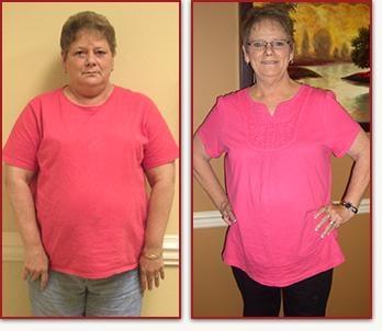 Glenda lost 78 pounds