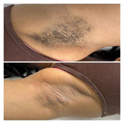 Underarm Wax