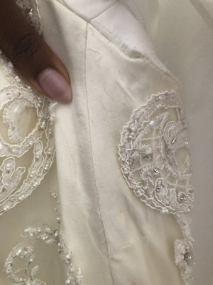 Burns to lace fabric