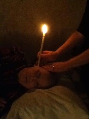 Ear Candling:for relief from wax blockage, tinnitus, etc.