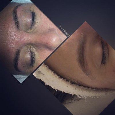 Before & After Brow Shaping