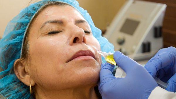 PRP injections for anti-aging