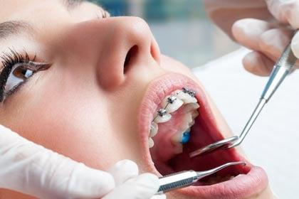 Orthodontic Dental Assistant Training