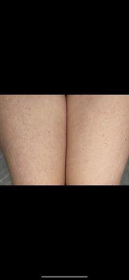 Before & After leg wax!