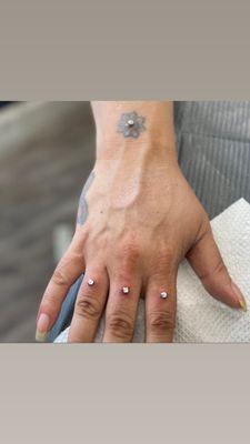 Finger & Wrist Dermals