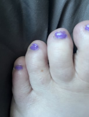 Toenails