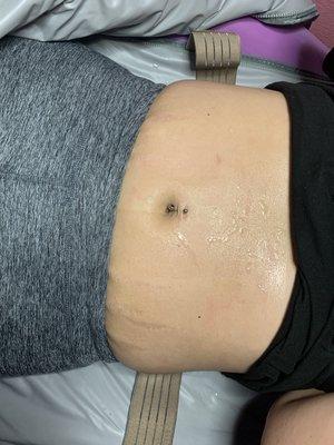 Cavitation /sauna weight loss treatment