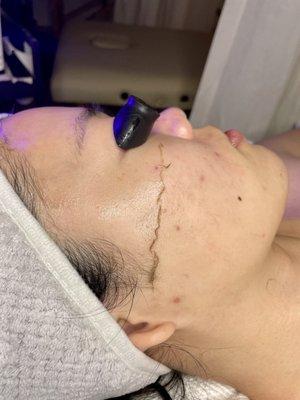 Dermaplaning Facial