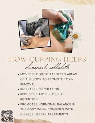 Information for Cupping