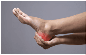 Manage Heel Pain TODAY!