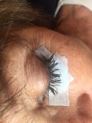 This lady's lashes have been severely damaged by these people at Everlasting skincare!