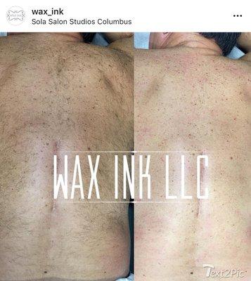 Back wax results