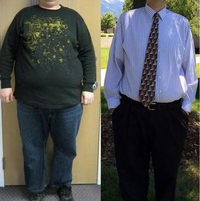 The left is me before surgery at 425 lbs.  The right is me 4 years after Duodenal Switch surgery with Dr. SImper at 240 lbs.