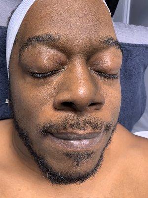 Vitamin C facial