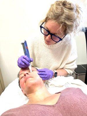 Plasma Pen MD |
Targets fine lines and wrinkles while stimulating collagen and elastin.