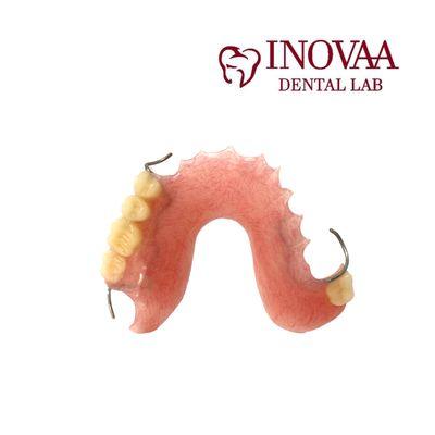 Mandibular Stayplate 4-6 Teeth