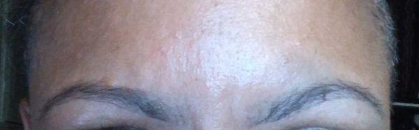 Ignore the shiny forehead but notice no hairs anywhere but the eyebrow.