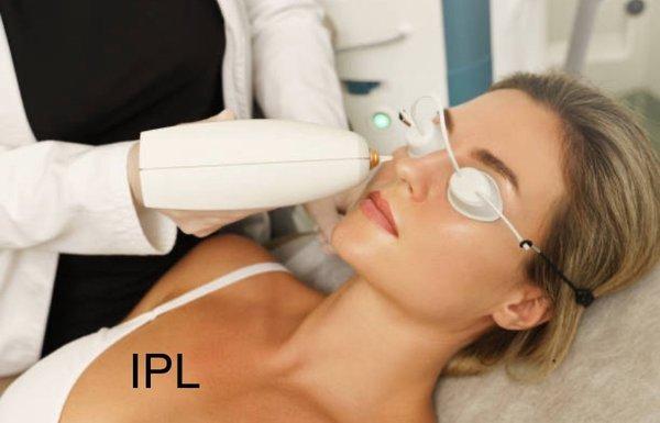 IPL Photo Facial