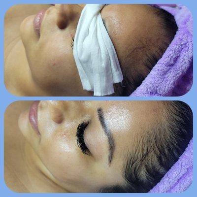 Resurfacing facial