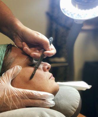 After a dermaplane you can expect to see an instant improvement in skin texture and tone!