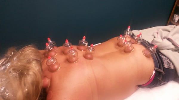 Cupping