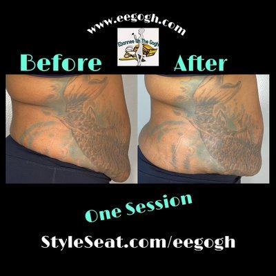 Body Contouring Fat Cavitation, Laser Lipolysis, RF skin tightening & Sauna Wrap