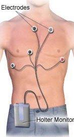 Holter Monitor - where it gets hooked up to you.