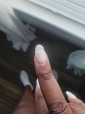 Cracked nail in