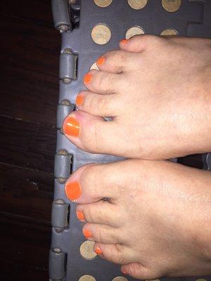 Sore toes from pedicure