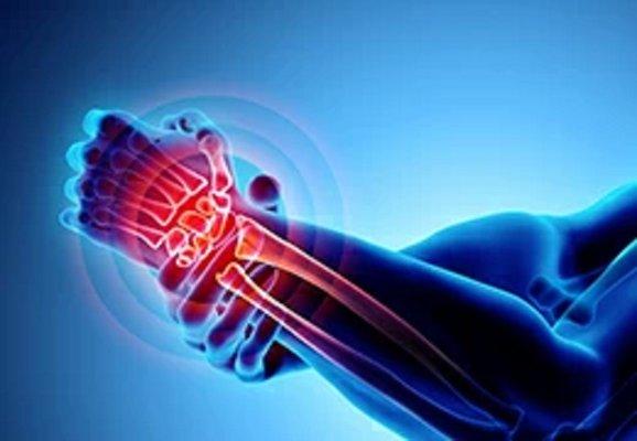 arthritis pain treatment