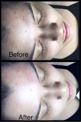 Want people to say wow your face looks amazing! Healing Beauty can help you with your skin goals!