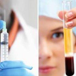 PRP Injections Services