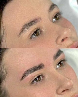 Before/after brow shaping