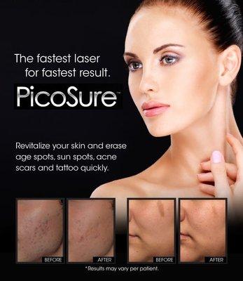 Focus Laser Skin Treatment