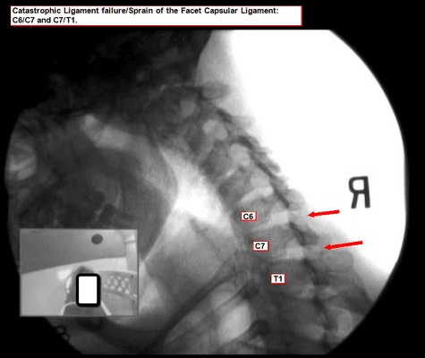 Digital Motion Xray