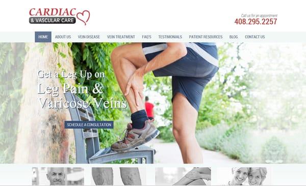 Website design http://varicoseveinssanjose.com/ by  http://creativetakemedical.com/