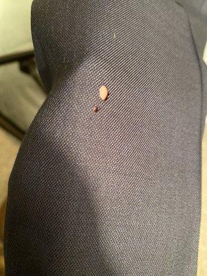 Holes at the bottom of pant leg.