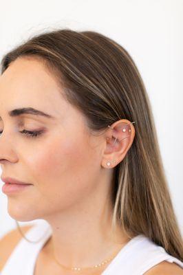 Ear acupuncture