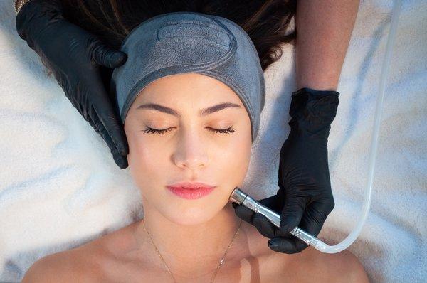 Microdermabrasion