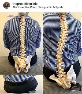 As you can see, sitting on your wallet completely throwing off the spine and can be a main factor contributing to sciatica.