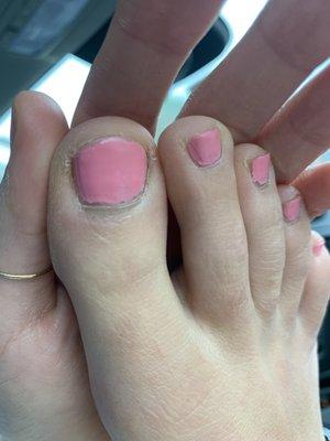 Less than a two week old pedicure