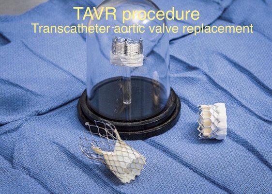 TAVR procedure