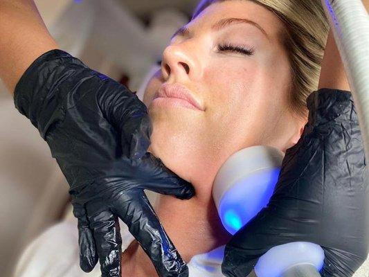 CryoSkin Facial 4.0