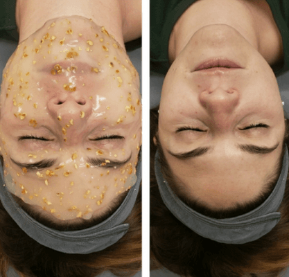 Dermaplane & Illuminating Orange Hydrojelly mask (smooth and glowing)